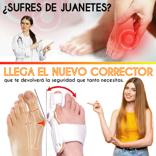 CORRECTOR DE JUANETES COMPRA 1 LLEVA 2